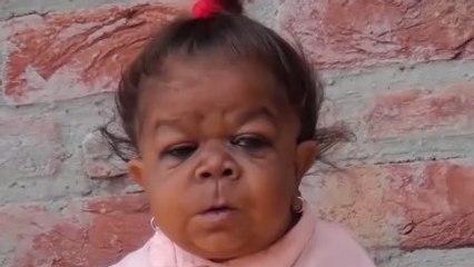 Manpreet Singh : cet homme de 21 ans a arrêté de grandir... à l'âge de 6 mois