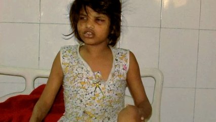 la vérité dramatique sur la fillette retrouvée vivante parmi les singes