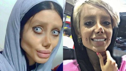 Sahar Tabar : On sait à quoi ressemblait la jeune fan d'Angelina Jolie avant ses 50 opérations