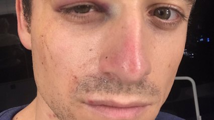 Violences à Paris : le journaliste Hugo Clément blessé au visage