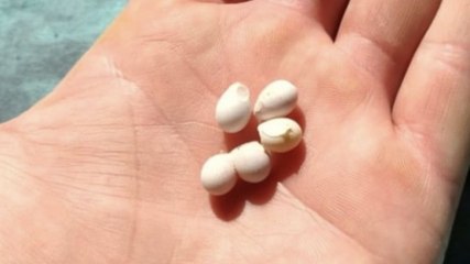 Il trouve de minuscules billes dans un arbre et fait une étonnante découverte en les regardant de plus près