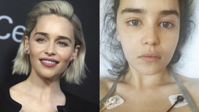 Emilia Clarke partage des photos choc de ses hospitalisations après ses deux AVC