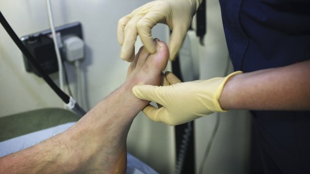 Il se plaint de douleurs au pied et découvre être atteint d'une maladie rare