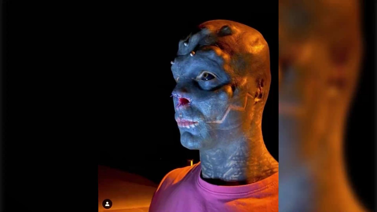 Transformation extrême : un Français se fait retirer le nez et les oreilles pour "tester" son corps