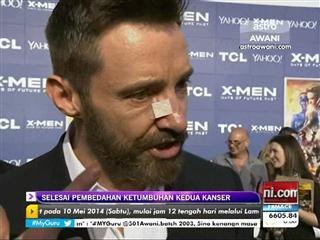 Hugh Jackman selesai pembedahan ketumbuhan kedua kanser