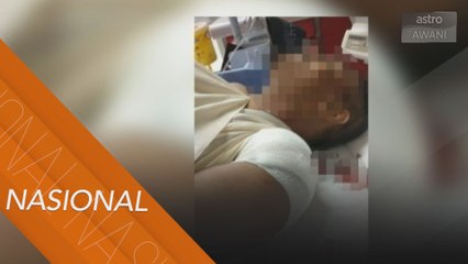 Abang sado kena tetak