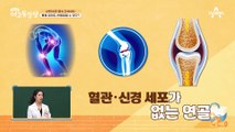 통증이 없어도 관절염을 걱정해야한다?! 갈수록 젊어지는 퇴행성 관절염 환자들