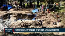 Alami Luka Bakar Hingga 90 Persen, Kondisi Dua Korban Ledakan Sumur Minyak di Aceh Kritis