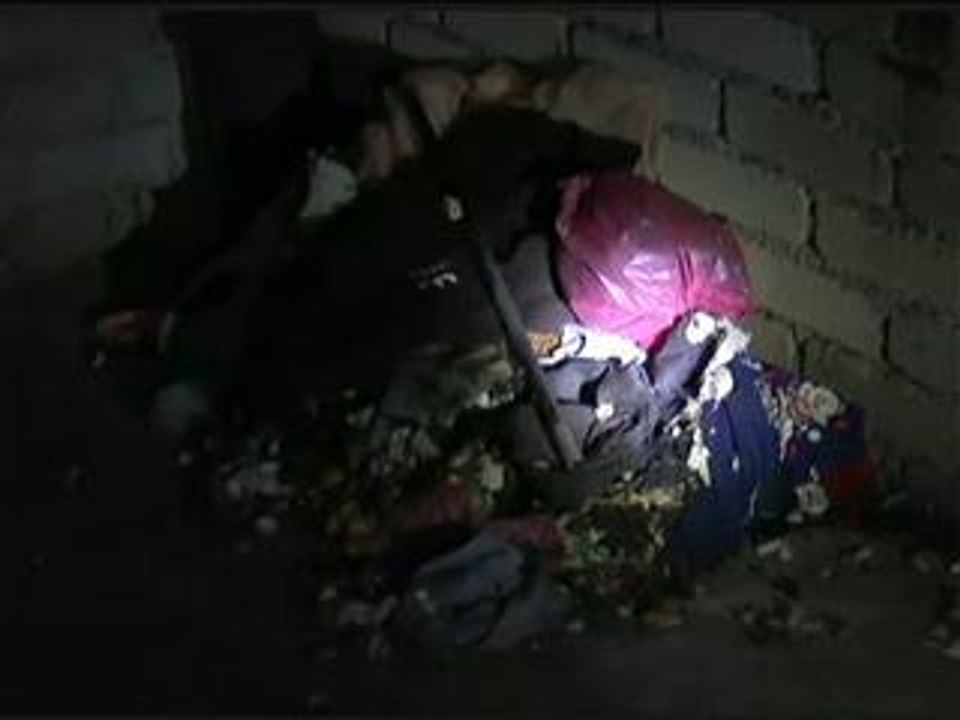 Wanita parah ditetak bekas suami