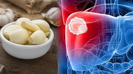 गर्मी में लहसुन खाना चाहिए या नहीं । गर्मी में लहसुन खाने से क्या होता है । Boldsky