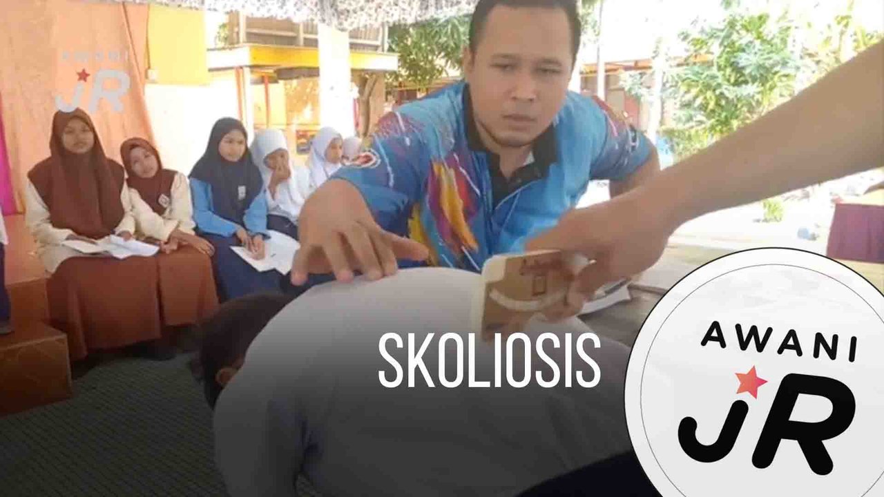 #AWANIJr: Skoliosis