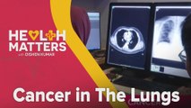 Health Matters with Dishen Kumar: Cancer in The Lungs