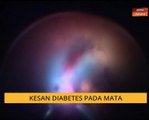 Kesan diabetis pada mata