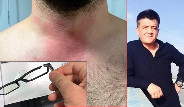 Doktoru darp eden uzman çavuş alkışlı protesto eşliğinde hastaneden ayrıldı