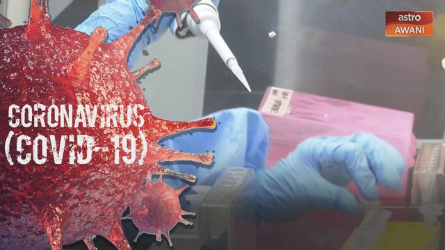 COVID-19: Malaysia catat 1 kes kematian, 84 kes keseluruhan