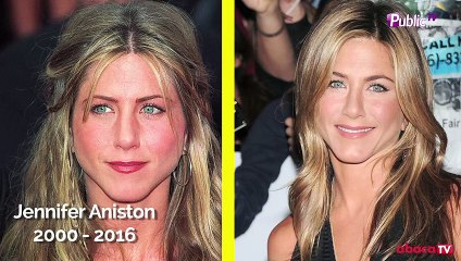 Avant/Après : 10 stars qui ont changé physiquement !