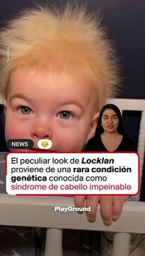 No tienes pelo necio, quizá sólo tengas síndrome de cabello impeinable