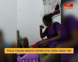 Polis tahan wanita dipercayai dera anak tiri