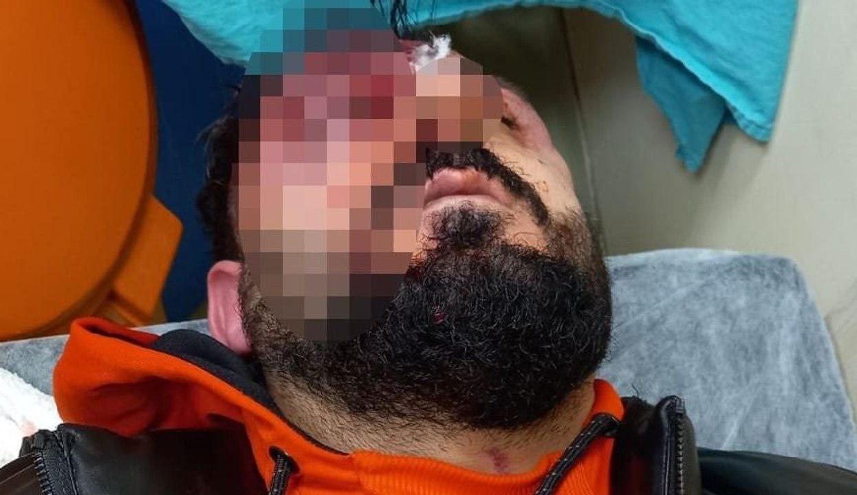 ‘Kime geldiniz’ dedi öldüresiye dayak yedi