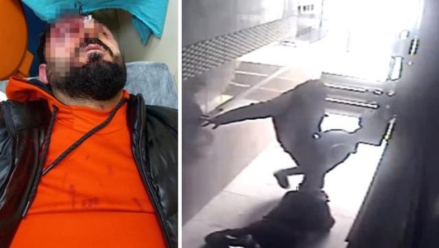 Binada gördüğü kişilere Kime geldiniz diyen genç öldüresiye dayak yedi