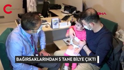 Bağırsaklarından 5 tane mıknatıslı bilye çıktı