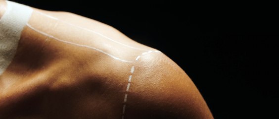 L'ASSE mobilisée contre le racisme et l'antisémitisme aux côtés de la LFP