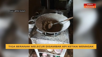 Tiga beranak melecur disambar api ketika memasak
