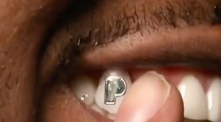 Gunna shows off $100,000 "Pushin P" diamond he placed on his tooth