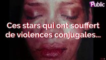 Vidéo : Ces stars qui ont souffert de violences conjugales…