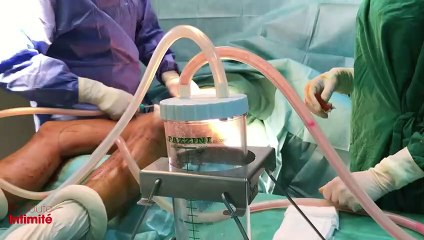 En toute Intimité : Kim Glow : Son opération de chirurgie esthétique !