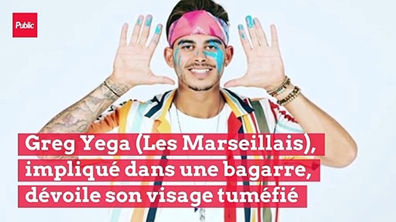 Greg Yega (Les Marseillais), impliqué dans une bagarre, dévoile son visage tuméfié