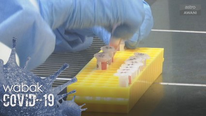 China nasihat KKM supaya tidak bergantung kepada rapid test kit