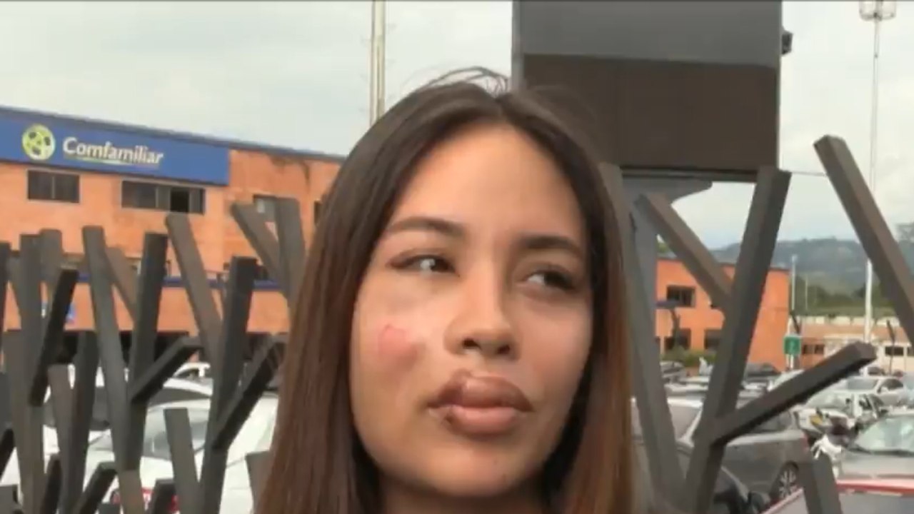 Mujer golpeada con piedra: "Sentí el golpe y cuando desperté estaba botando sangre"