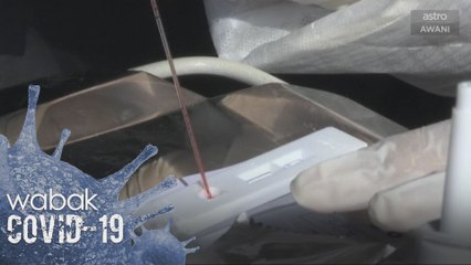 Kes positif COVID-19 seluruh dunia lepasi 9.03 juta