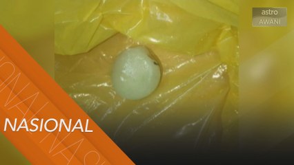 Kanak-kanak lelaki 3 tahun mati tercekik buah rambutan