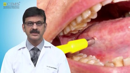 CIMS HOSPITAL - Dr. Darshan Bhansali - Mouth Cancer Causes And Treatment