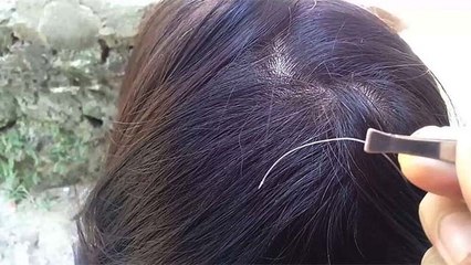 पहला White Hair आने पर भूलकर भी ना करें ये गलती कर लें ये काम | Boldsky