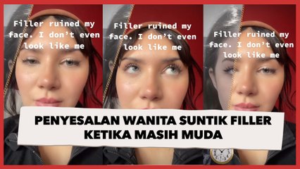 Penyesalan Wanita Suntik Filler ketika Masih Muda, Wajahnya Kini Terlihat 10 Tahun Lebih Tua