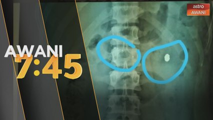 Lelaki cedera terkena peluru sesat
