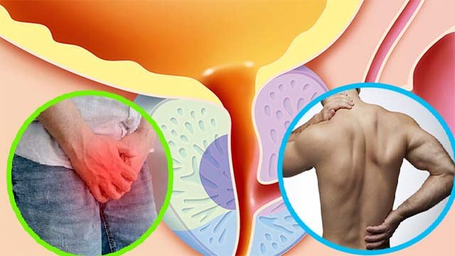 पुरषों में Body Pain होना प्रोस्टेट इन्फेक्शन के लक्षण, क्या है कारण और उपाय |Boldsky