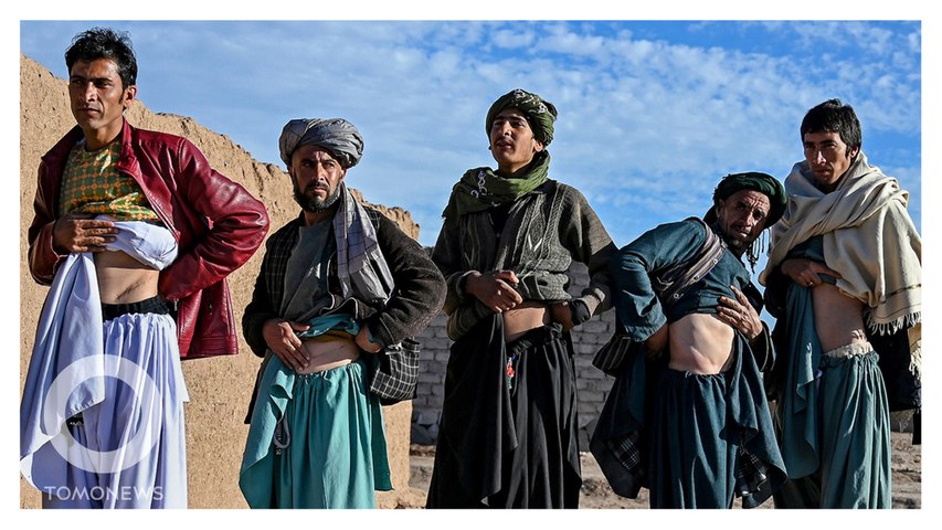 Warga Afganistan Terpaksa Jual Ginjal Demi Bertahan Hidup