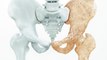 Médico reumatologista fala sobre sintomas, tratamentos e causas das Osteoporose
