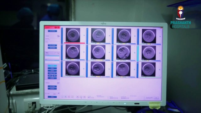 IVF Lab Process _ IVF Lab Infrastructure _ IVF Treatment for Pregnancy _ Inside The IVF Laboratory