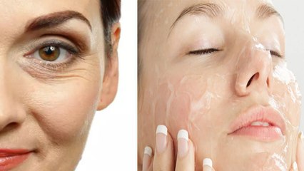 40 Age के बाद भी Homemade Face Gel से Wrinkle गायब, MUST WATCH VIDEO | Boldsky