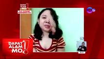 Dapat Alam Mo!: Inaakalang kuliti at lumalaking eye bags, senyales pala ng karamdaman?