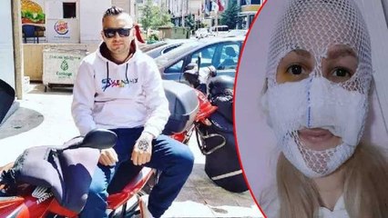 Sultan'ın yüzüne kimyasal madde atmıştı! Soner Bolat için yakalama kararı çıkarıldı