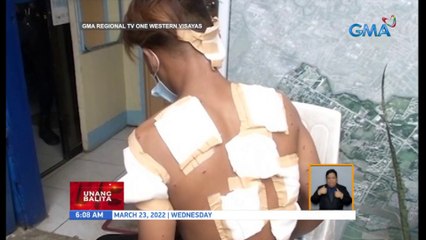 Binatilyo, sugatan matapos barilin ng shotgun ng guwardiya | UB