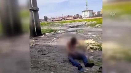 Trafo merkezinde elektrik akımına kapılan kişi ağır yaralandı