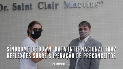 Síndrome de Down: data internacional traz reflexões sobre superação de preconceitos