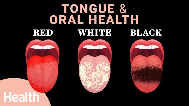 What Your Tongue Tells You About Your Health | Tongue Color, Taste Buds, COVID Tongue, & Oral Health